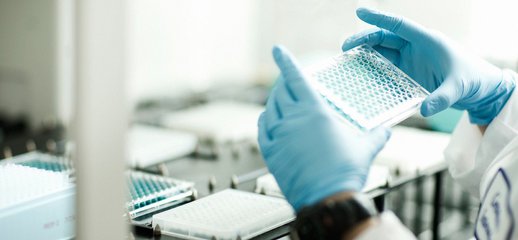 PNAS發(fā)現(xiàn)濾泡輔助性T細(xì)胞分化調(diào)控新機(jī)制