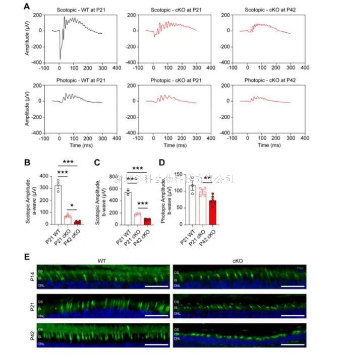 eLife：科學(xué)家揭示光感受器細胞中谷氨酰胺代謝對視網(wǎng)膜健康的決定性作用